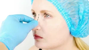 هزینه جراحی بینی در آمل