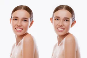 قیمت عمل بینی در آمل - ارزان‌ترین