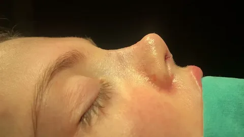 قیمت عمل بینی در آمل - ارزان‌ترین